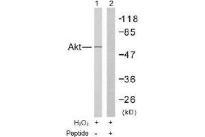 Image no. 2 for anti-V-Akt Murine Thymoma Viral Oncogene Homolog 1 (AKT1) (Thr308) antibody (ABIN197195) (AKT1 抗体  (Thr308))