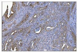IHC analysis of MERTK using anti-MERTK antibody (ABIN7600623). (MERTK 抗体  (AA 21-489))