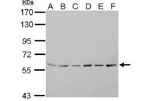 WB Image ASC1 antibody detects TRIP4 protein by Western blot analysis. (TRIP4 抗体)