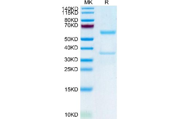 MFAP5 Protein (AA 22-173) (Fc Tag)