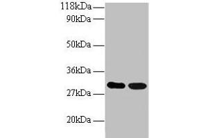 Western blot All lanes: ARHGEF18 antibody at 2 μg/mL Lane 1: EC109 whole cell lysate Lane 2: 293T whole cell lysate Secondary Goat polyclonal to rabbit IgG at 1/15000 dilution Predicted band size: 131, 115 kDa Observed band size: 30 kDa (ARHGEF18 抗体  (AA 159-551))