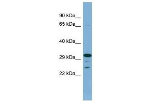 DHRS9 antibody used at 1 ug/ml to detect target protein. (DHRS9 抗体)