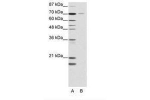 Image no. 1 for anti-Nuclear Receptor Subfamily 2, Group C, Member 1 (NR2C1) (AA 525-574) antibody (ABIN202801) (NR2C1 抗体  (AA 525-574))
