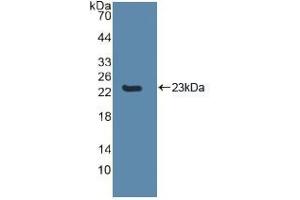 Western blot analysis of recombinant Human CASP8. (Caspase 8 抗体  (AA 217-384))