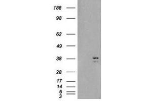Image no. 2 for anti-Sirtuin 4 (SIRT4) (C-Term) antibody (ABIN374409) (SIRT4 抗体  (C-Term))