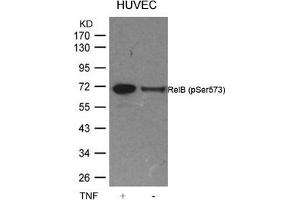 Western blot analysis of extracts from HUVEC cells untreated or treated with TNF using RelB(Phospho-Ser573) Antibody.