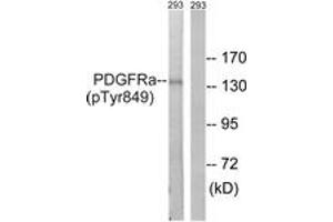 Western blot analysis of extracts from 293 cells, using PDGFRa (Phospho-Tyr849) Antibody. (PDGFRA 抗体  (pTyr849))