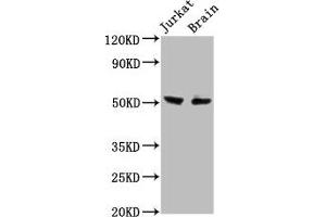 Western Blot Positive WB detected in: Jurkat whole cell lysate, Rat brain tissue All lanes: ONECUT1 antibody at 7. (ONECUT1 抗体  (AA 192-292))