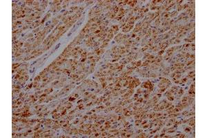 Immunohistochemistry (IHC) image for anti-ATP Synthase, H+ Transporting, Mitochondrial F1 Complex, beta Polypeptide (ATP5B) antibody (ABIN7127355)