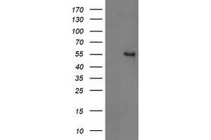 Western Blotting (WB) image for anti-Glucosidase, Beta, Acid 3 (Cytosolic) (GBA3) (AA 1-150), (AA 370-469) antibody (ABIN1490582) (GBA3 抗体  (AA 1-150, AA 370-469))