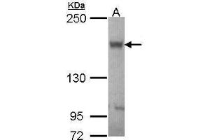 Western Blotting (WB) image for anti-ATP-Binding Cassette, Sub-Family B (MDR/TAP), Member 11 (ABCB11) (Internal Region) antibody (ABIN2855437)