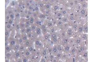 DAB staining on IHC-P; Samples: Mouse Liver Tissue (AGXT2 抗体  (AA 226-513))