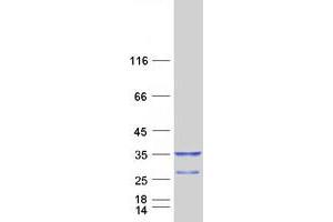 Western Blotting (WB) image for Kv Channel Interacting Protein 2 (KCNIP2) (Transcript Variant 3) protein (Myc-DYKDDDDK Tag) (ABIN2724029)