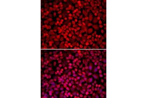 Immunofluorescence analysis of U20S cell using NCOA1 antibody. (NCOA1 抗体)