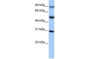 Western Blotting (WB) image for anti-GID Complex Subunit 4, VID24 Homolog (GID4) antibody (ABIN2459711) (GID4 抗体)