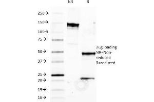 SDS-PAGE Analysis Purified HLA-B Mouse Monoclonal Antibody (JOAN-1). (HLA-B 抗体)