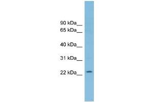 WB Suggested Anti-RNF125 Antibody Titration: 0. (RNF125 抗体  (Middle Region))