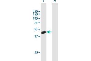 Western Blot analysis of TSPYL3 expression in transfected 293T cell line by TSPYL3 MaxPab polyclonal antibody. (TSPY-Like 3 抗体  (AA 1-355))