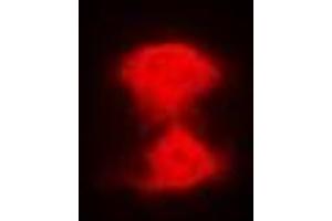 Immunofluorescent analysis of AIPL1 staining in Hela cells. (AIPL1 抗体)