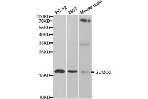 Western blot analysis of extracts of various cell lines, using SUMO2 antibody. (SUMO2 抗体)