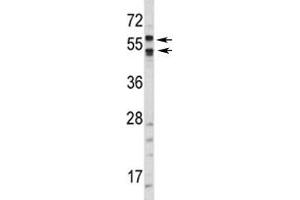 Western blot analysis of CA9 antibody and HepG2 lysate. (CA9 抗体  (AA 63-90))