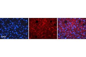 Rabbit Anti-TMED1 Antibody    Formalin Fixed Paraffin Embedded Tissue: Human Adult liver  Observed Staining: Membrane Primary Antibody Concentration: 1:100 Secondary Antibody: Donkey anti-Rabbit-Cy2/3 Secondary Antibody Concentration: 1:200 Magnification: 20X Exposure Time: 0. (TMED1 抗体  (Middle Region))