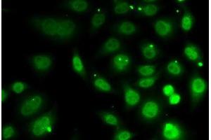 Immunofluorescence analysis of MCF7 cells using DR1 Polyclonal Antibody (DR1 抗体)