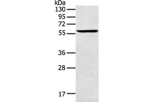 Western Blotting (WB) image for anti-Spermatogenesis Associated 6 (SPATA6) antibody (ABIN2428883) (SPATA6 抗体)