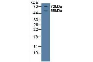 Detection of GR in Porcine Brian Tissue using Polyclonal Antibody to Glucocorticoid Receptor (GR) (Glucocorticoid Receptor 抗体  (AA 598-755))