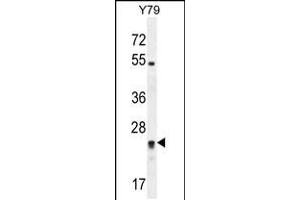 Western blot analysis in Y79 cell line lysates (35ug/lane). (DPCD 抗体  (AA 96-136))