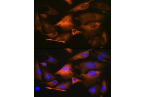 Immunofluorescence (IF) image for anti-Stathmin 1 (STMN1) antibody (ABIN1678518)