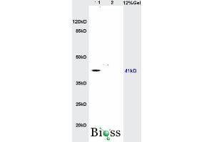 SDS-PAGE (SDS) image for anti-1-Acylglycerol-3-Phosphate O-Acyltransferase 4 (AGPAT4) (AA 231-330) antibody (ABIN708671)