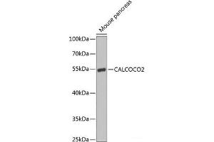 Western blot analysis of extracts of Mouse pancreas using CALCOCO2 Polyclonal Antibody at dilution of 1:1000. (CALCOCO2 抗体)