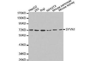 Western blot analysis of extracts of various cell lines, using SYVN1 antibody. (SYVN1 抗体  (C-Term))