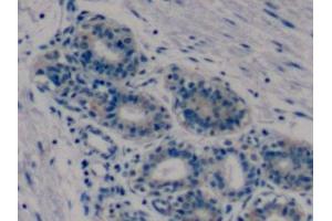 Immunohistochemistry (IHC) image for anti-Matrix Metallopeptidase 9 (Gelatinase B, 92kDa Gelatinase, 92kDa Type IV Collagenase) (MMP9) (AA 213-399) antibody (ABIN7425935)