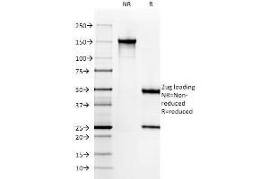 SDS-PAGE Analysis Purified SM-MHC Monoclonal Antibody (SMMS-1). (MYH11 抗体)