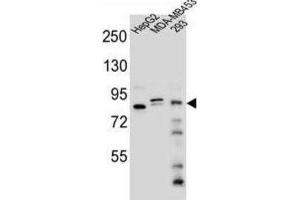 Western Blotting (WB) image for anti-KAT8 Regulatory NSL Complex Subunit 3 (KANSL3) antibody (ABIN2995818) (KANSL3 抗体)
