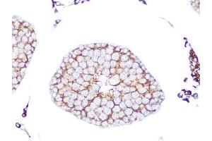 Immunohistochemistry of paraffin-embedded rat testis using RA Rabbit mAb (ABIN7269817) at dilution of 1:100 (40x lens). (RAB9A 抗体)