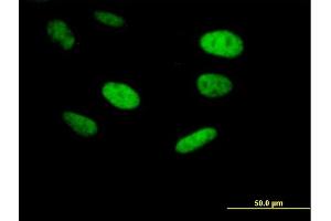 Immunofluorescence of purified MaxPab antibody to ING5 on HeLa cell. (ING5 抗体  (AA 1-240))