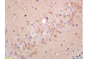 Formalin-fixed and paraffin embedded rat brain labeled with Anti-MRGX1/MRGPRC/SNSR Polyclonal Antibody, Unconjugated (ABIN718751) at 1:200 followed by conjugation to the secondary antibody and DAB staining. (MRGPRX1/3/4 (AA 21-120) 抗体)