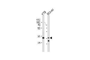 Western blot analysis in Y79 cell line and mouse liver lysates (35ug/lane). (CSDA 抗体  (AA 152-181))