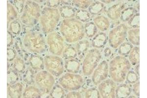 Immunohistochemistry of paraffin-embedded human kidney tissue using ABIN7142338 at dilution of 1:100 (PDPK1 抗体  (AA 277-556))