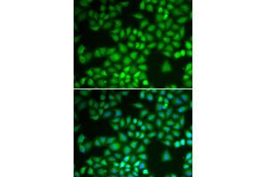Immunofluorescence analysis of A549 cells using NFKB1 antibody (ABIN5974018). (NFKB1 抗体)