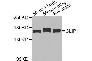 Western blot analysis of extracts of various cells, using CLIP1 antibody. (CLIP1 抗体)