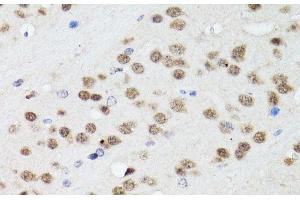 Immunohistochemistry of paraffin-embedded Mouse brain using TIA1 Polyclonal Antibody at dilution of 1:100 (40x lens). (TIA1 抗体)
