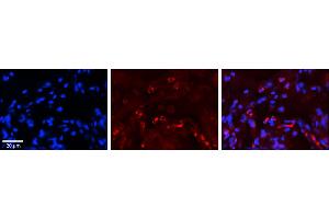 Rabbit Anti-GAA Antibody     Formalin Fixed Paraffin Embedded Tissue: Human Lung Tissue  Observed Staining: Cytoplasmic in alveolar type I cells  Primary Antibody Concentration: 1:100  Other Working Concentrations: 1/600  Secondary Antibody: Donkey anti-Rabbit-Cy3  Secondary Antibody Concentration: 1:200  Magnification: 20X  Exposure Time: 0. (GAA 抗体  (N-Term))