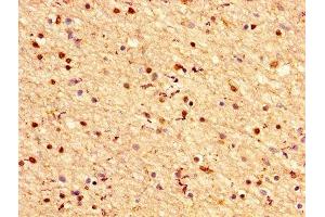 Immunohistochemistry (IHC) image for anti-Crystallin, alpha B (CRYAB) (AA 1-175) antibody (ABIN7143857)