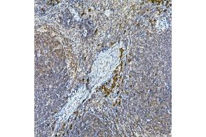Immunohistochemistry (IHC) image for anti-Nuclear Receptor Subfamily 4, Group A, Member 3 (NR4A3) (AA 1-280) antibody (ABIN6148988)