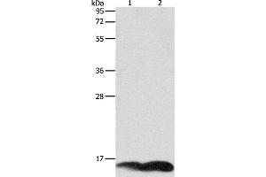 Western Blot analysis of A549 and Jurkat cell using PFN1 Polyclonal Antibody at dilution of 1:1000 (PFN1 抗体)