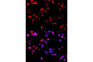 Immunofluorescence analysis of GFP-RNF168 transgenic U2OS cells using RPA2 antibody. (RPA2 抗体  (AA 80-270))